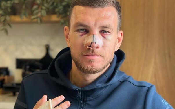 Edin Džeko: Maximus Jedanaesti