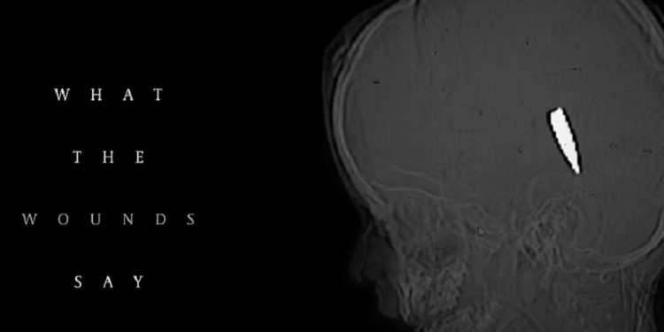 Strani doktori iz Gaze: Najmanje 114 djece ubijeno metkom u glavu ili vrat